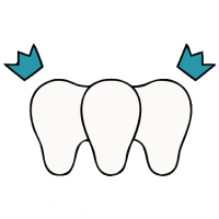 Teeth Whitening